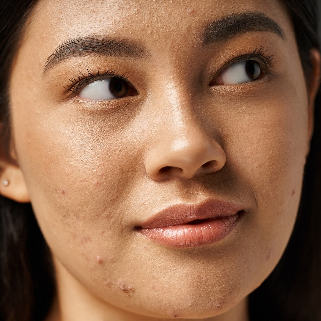 SKINPURE Nahrungsergänzungskapseln mit Brokkoli-, Erdrauch- und Klettenextrakt sowie Niacinamid zur Unterstützung reiner und gesunder Haut